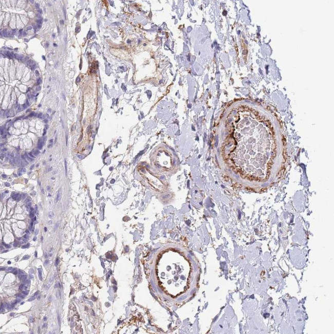 LEPROTL1 Antibody in Immunohistochemistry (Paraffin) (IHC (P))