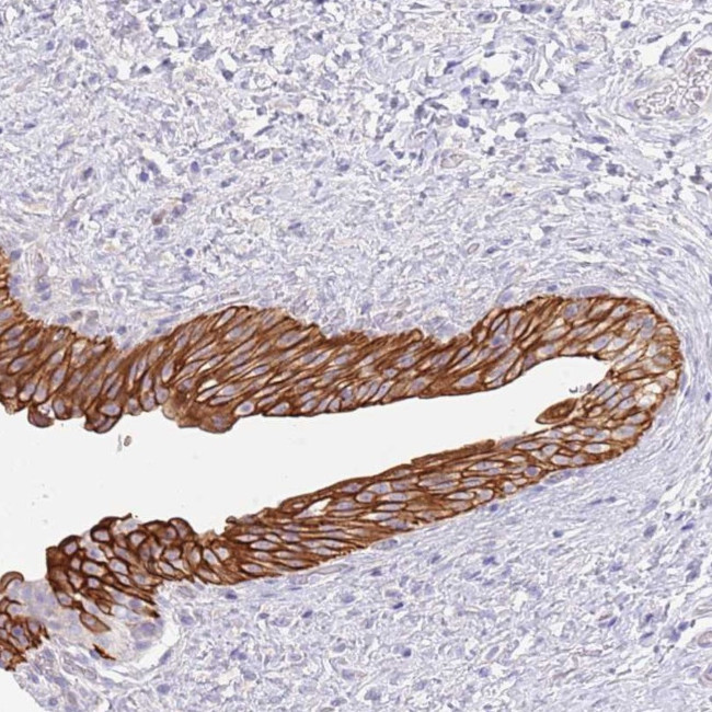 CCDC149 Antibody in Immunohistochemistry (Paraffin) (IHC (P))