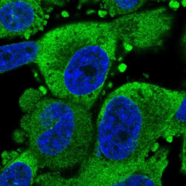 TRAPPC6B Antibody in Immunocytochemistry (ICC/IF)