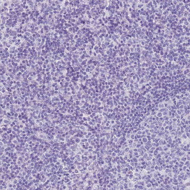 ACSS3 Antibody in Immunohistochemistry (Paraffin) (IHC (P))