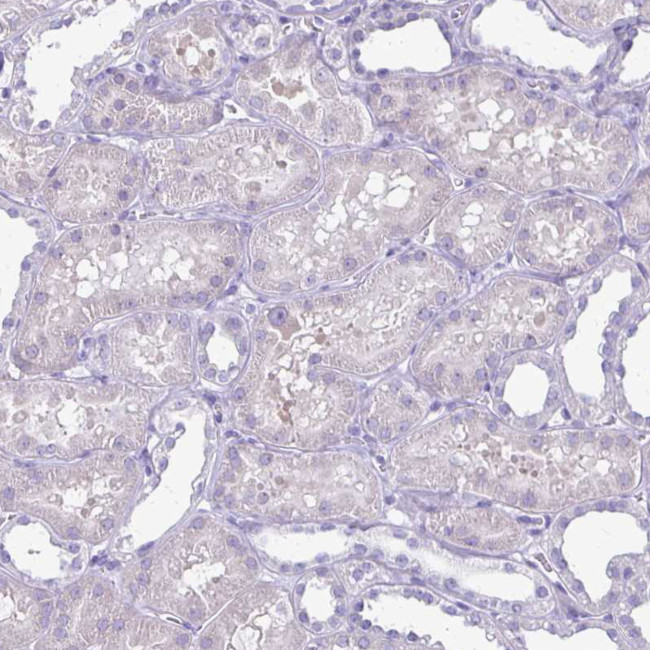 PLXNB3 Antibody in Immunohistochemistry (Paraffin) (IHC (P))