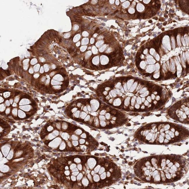 ZNF428 Antibody in Immunohistochemistry (Paraffin) (IHC (P))
