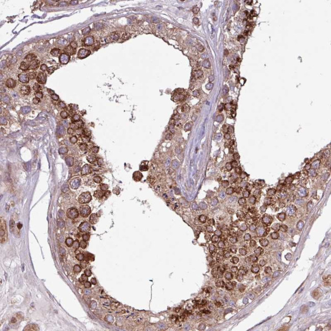 PDPR Antibody in Immunohistochemistry (Paraffin) (IHC (P))
