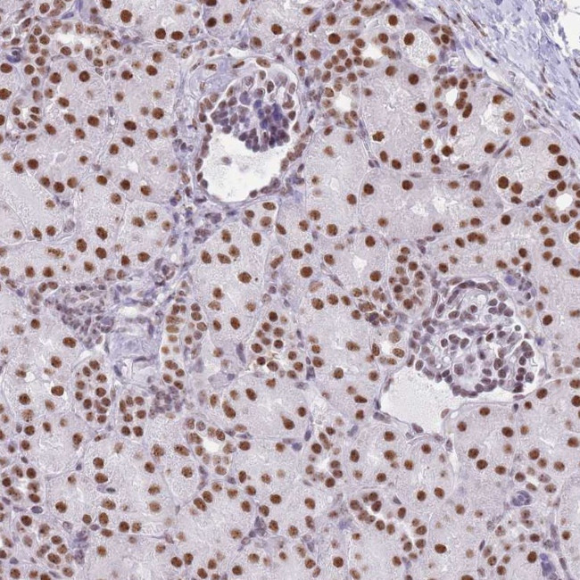 EVC2 Antibody in Immunohistochemistry (Paraffin) (IHC (P))