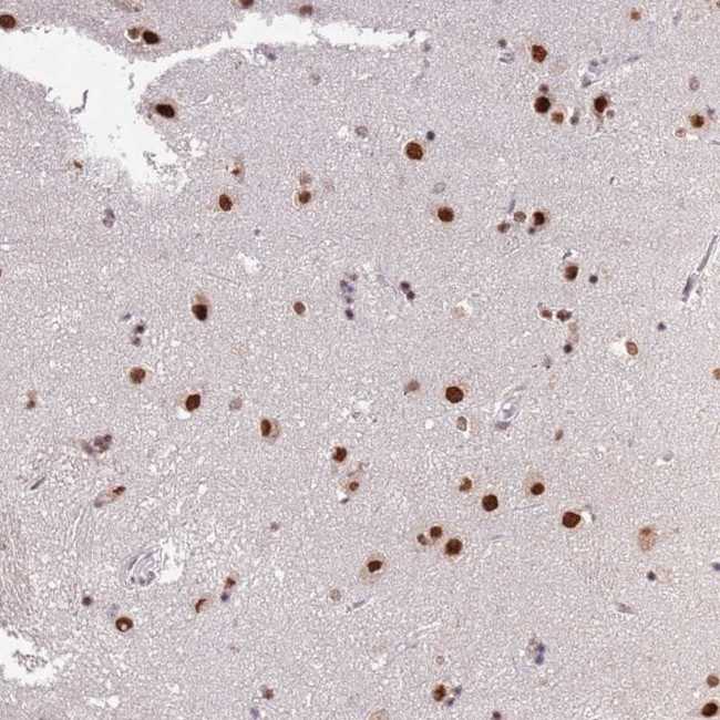 C11orf46 Antibody in Immunohistochemistry (Paraffin) (IHC (P))