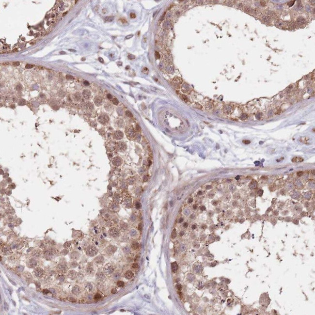 VPS52 Antibody in Immunohistochemistry (IHC)
