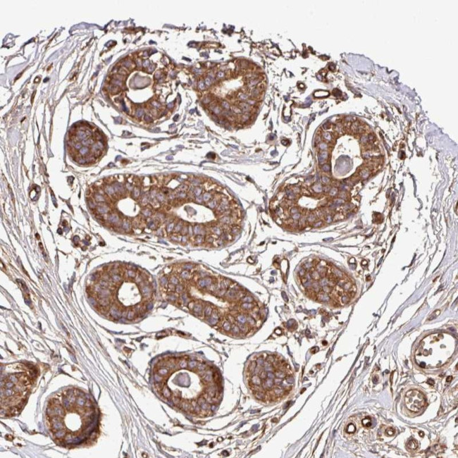 CWH43 Antibody in Immunohistochemistry (Paraffin) (IHC (P))