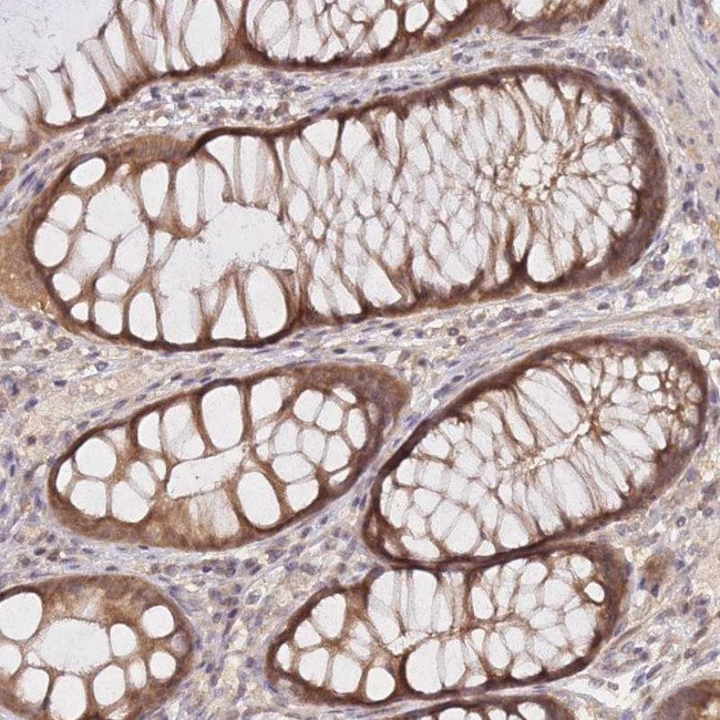 KIAA1191 Antibody in Immunohistochemistry (Paraffin) (IHC (P))