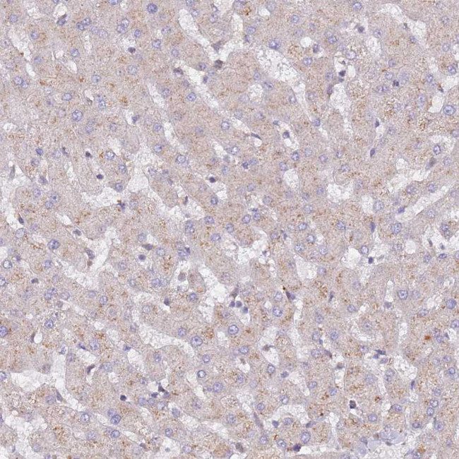 SPDL1 Antibody in Immunohistochemistry (Paraffin) (IHC (P))