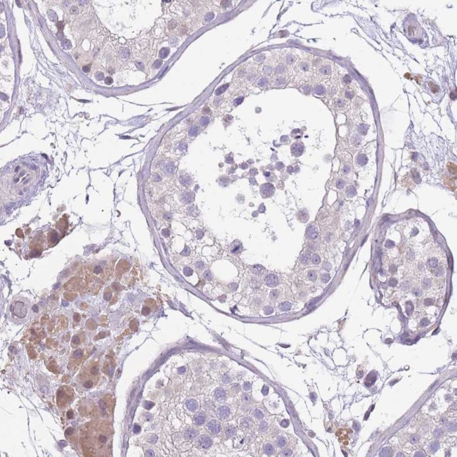 WDR70 Antibody in Immunohistochemistry (Paraffin) (IHC (P))