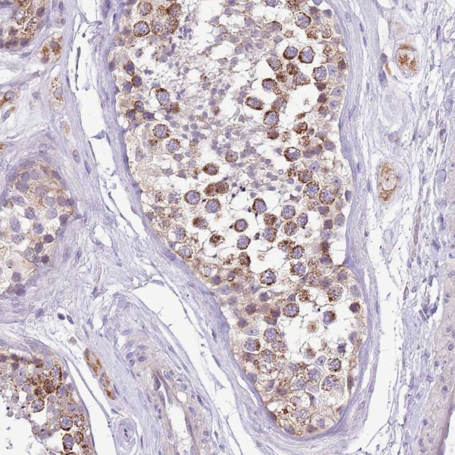 COX17 Antibody in Immunohistochemistry (Paraffin) (IHC (P))