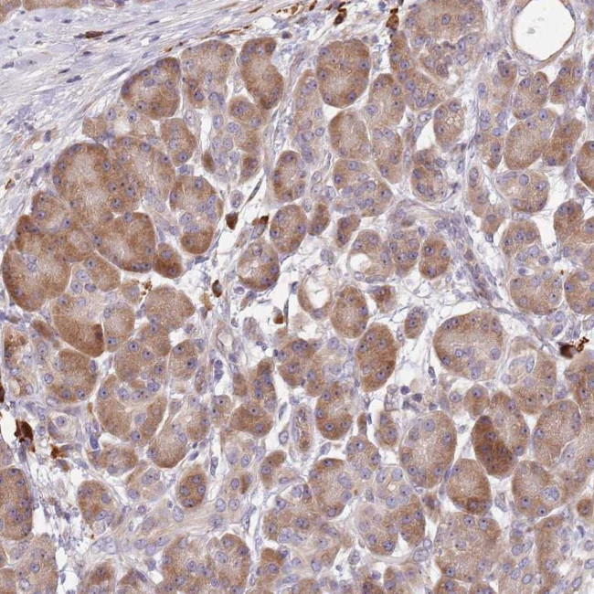CCDC140 Antibody in Immunohistochemistry (Paraffin) (IHC (P))