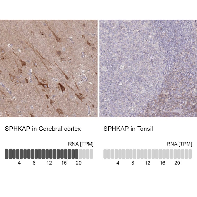 SPHKAP Antibody in Immunohistochemistry (IHC)