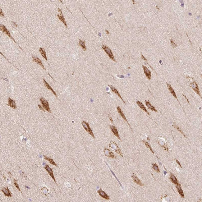 TBC1D2B Antibody in Immunohistochemistry (Paraffin) (IHC (P))
