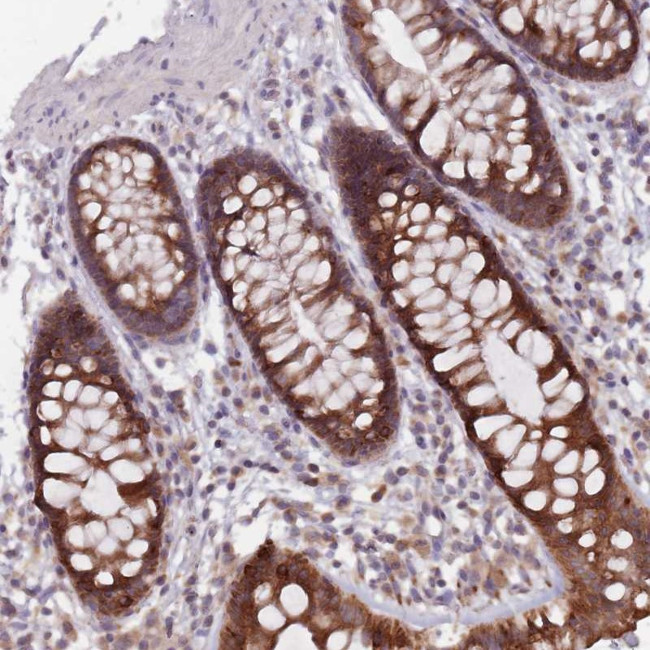 ADAL Antibody in Immunohistochemistry (Paraffin) (IHC (P))