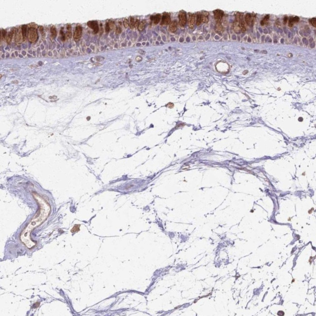 CCDC168 Antibody in Immunohistochemistry (Paraffin) (IHC (P))