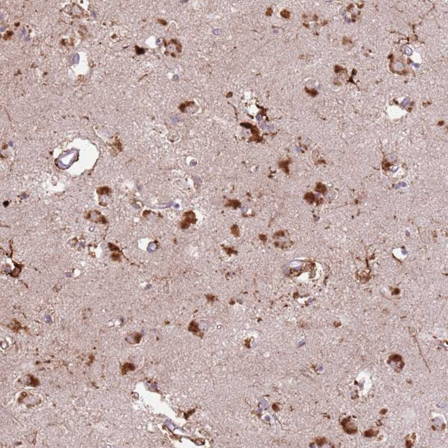 GDPGP1 Antibody in Immunohistochemistry (Paraffin) (IHC (P))