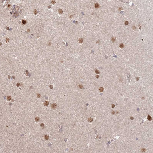 HAUS3 Antibody in Immunohistochemistry (Paraffin) (IHC (P))