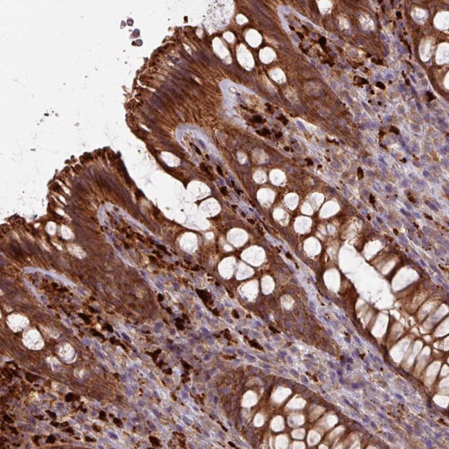 CCDC68 Antibody in Immunohistochemistry (Paraffin) (IHC (P))