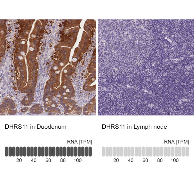DHRS11 Antibody in Immunohistochemistry (IHC)