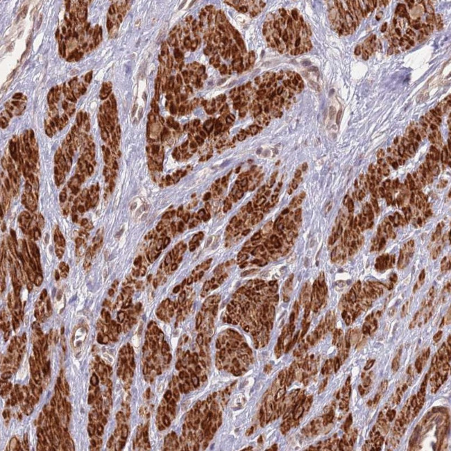 CCDC154 Antibody in Immunohistochemistry (Paraffin) (IHC (P))