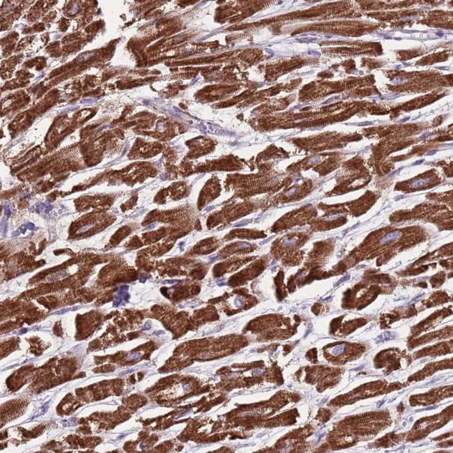 GAS8 Antibody in Immunohistochemistry (Paraffin) (IHC (P))