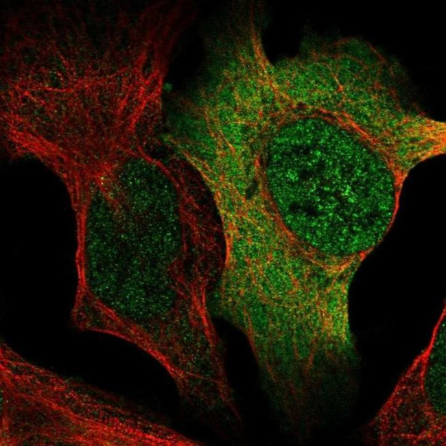 AP5S1 Antibody in Immunocytochemistry (ICC/IF)