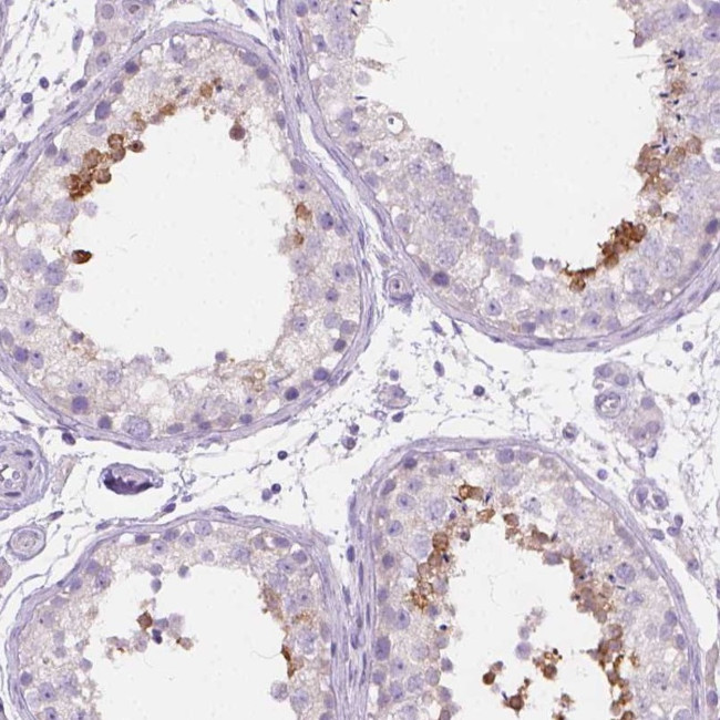 PDCL2 Antibody in Immunohistochemistry (Paraffin) (IHC (P))