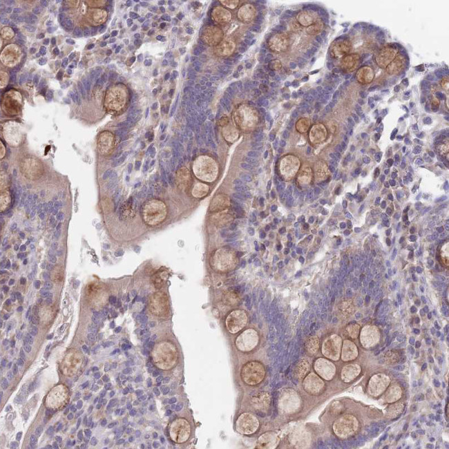 FTSJD1 Antibody in Immunohistochemistry (Paraffin) (IHC (P))