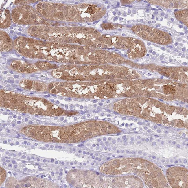 TMEM185A Antibody in Immunohistochemistry (Paraffin) (IHC (P))