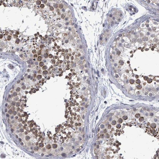 PTPN20A Antibody in Immunohistochemistry (IHC)