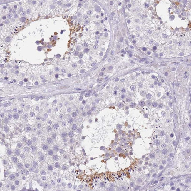TCP11 Antibody in Immunohistochemistry (Paraffin) (IHC (P))