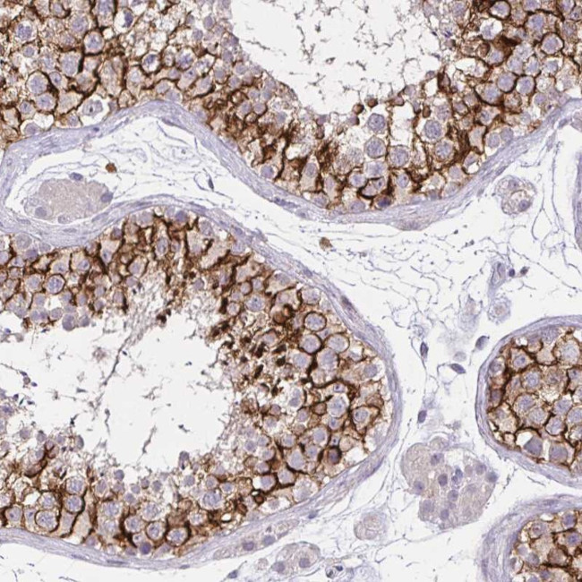 KIAA1210 Antibody in Immunohistochemistry (Paraffin) (IHC (P))