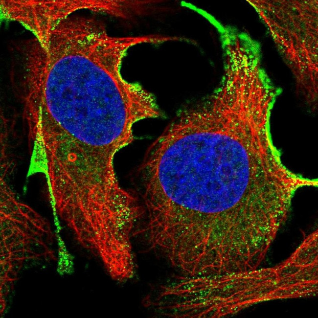 CTDSPL Antibody in Immunocytochemistry (ICC/IF)