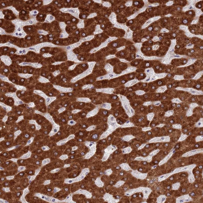 ZNF140 Antibody in Immunohistochemistry (Paraffin) (IHC (P))