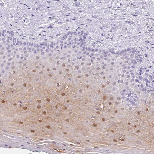 SERPINB4 Antibody in Immunohistochemistry (Paraffin) (IHC (P))