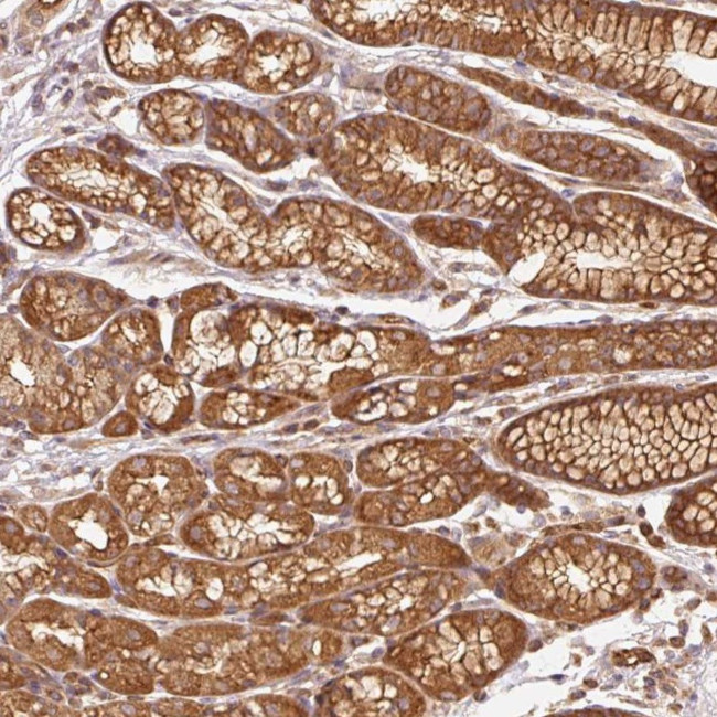 Adenylate Cyclase 4 Antibody in Immunohistochemistry (Paraffin) (IHC (P))