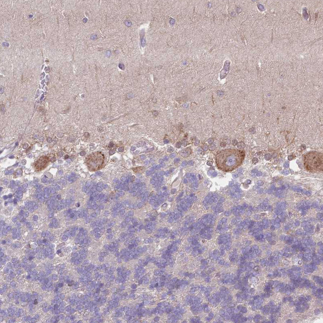 SLC26A6 Antibody in Immunohistochemistry (Paraffin) (IHC (P))