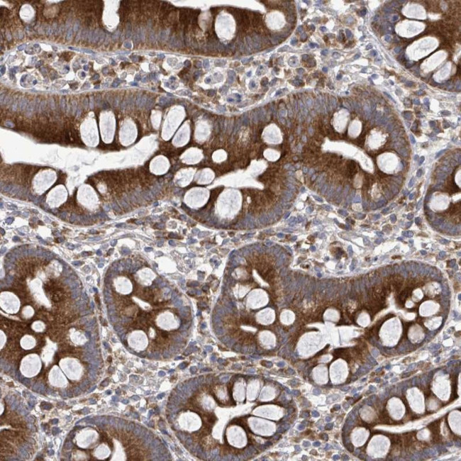 SAR1B Antibody in Immunohistochemistry (Paraffin) (IHC (P))