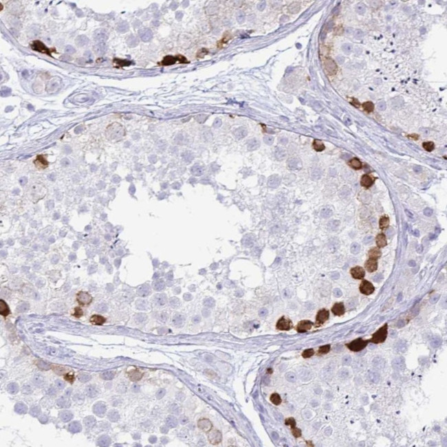 ERICH6 Antibody in Immunohistochemistry (Paraffin) (IHC (P))