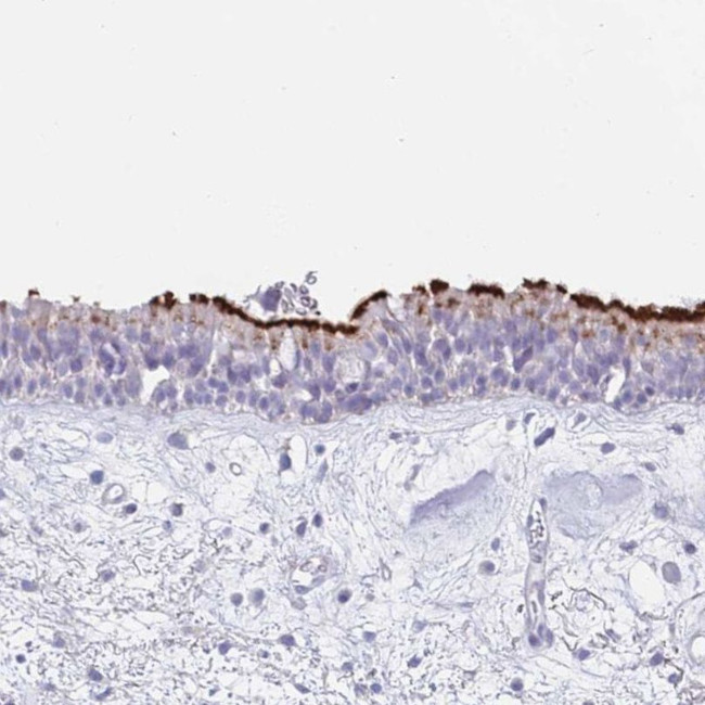 CPXM2 Antibody in Immunohistochemistry (IHC)