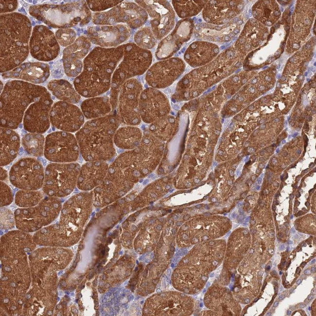 PRR32 Antibody in Immunohistochemistry (Paraffin) (IHC (P))