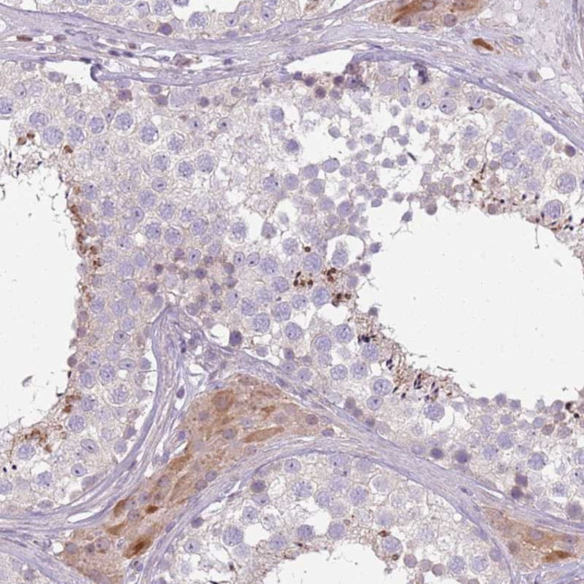 SPAG4 Antibody in Immunohistochemistry (Paraffin) (IHC (P))