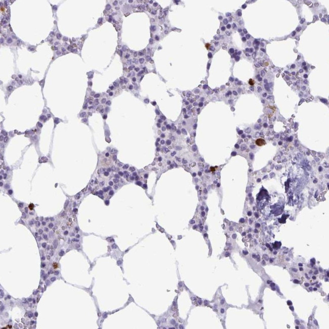 IBTK Antibody in Immunohistochemistry (Paraffin) (IHC (P))