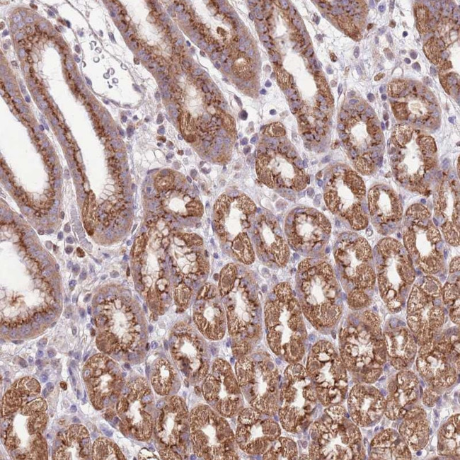 ARL2BP Antibody in Immunohistochemistry (Paraffin) (IHC (P))