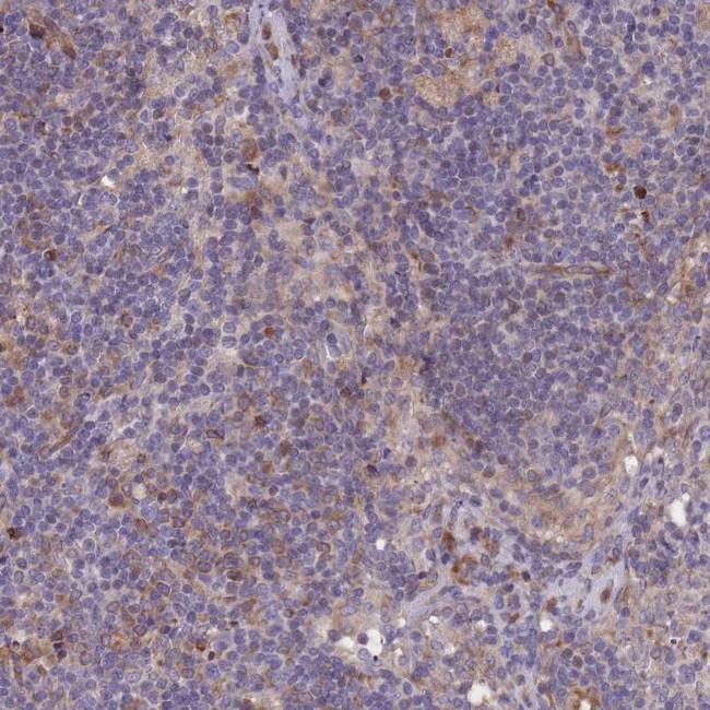 KIAA0922 Antibody in Immunohistochemistry (IHC)