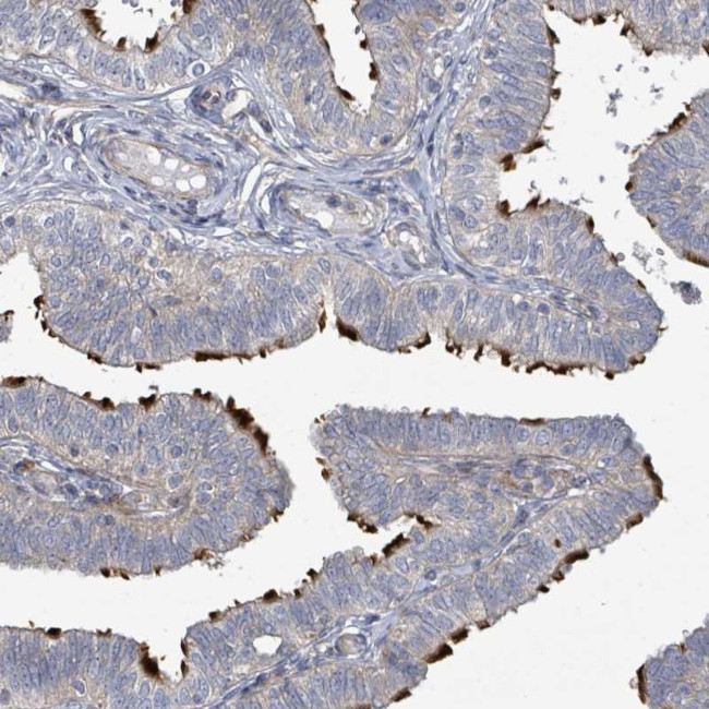 CCDC173 Antibody in Immunohistochemistry (Paraffin) (IHC (P))