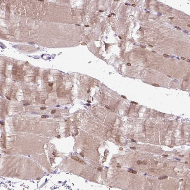 FAM184B Antibody in Immunohistochemistry (Paraffin) (IHC (P))