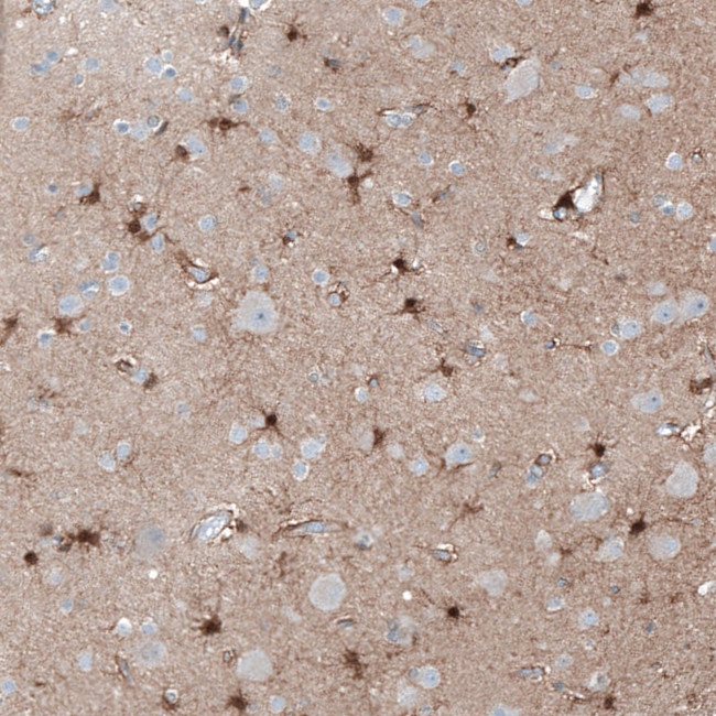 TMEM255A Antibody in Immunohistochemistry (Paraffin) (IHC (P))