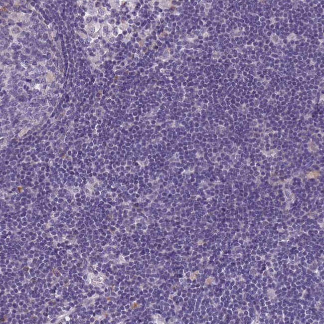 COL27A1 Antibody in Immunohistochemistry (Paraffin) (IHC (P))